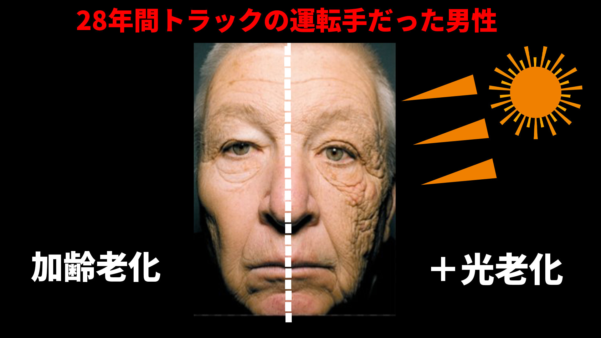 紫外線と老化の関係